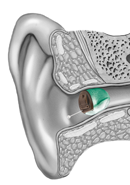 iic hearing aids | Custom Hearing Solutions - Omaha and Lincoln Nebraska